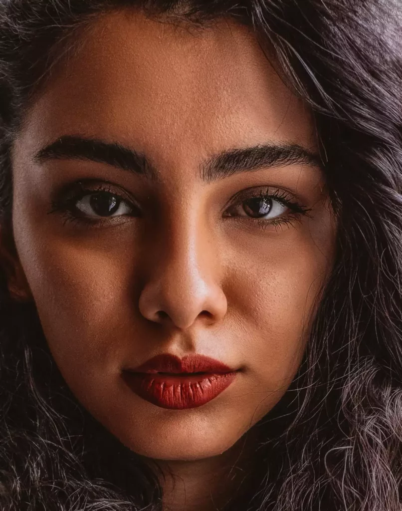 Cómo solucionar problemas con las ojeras 10 Clínica de estética ojeras